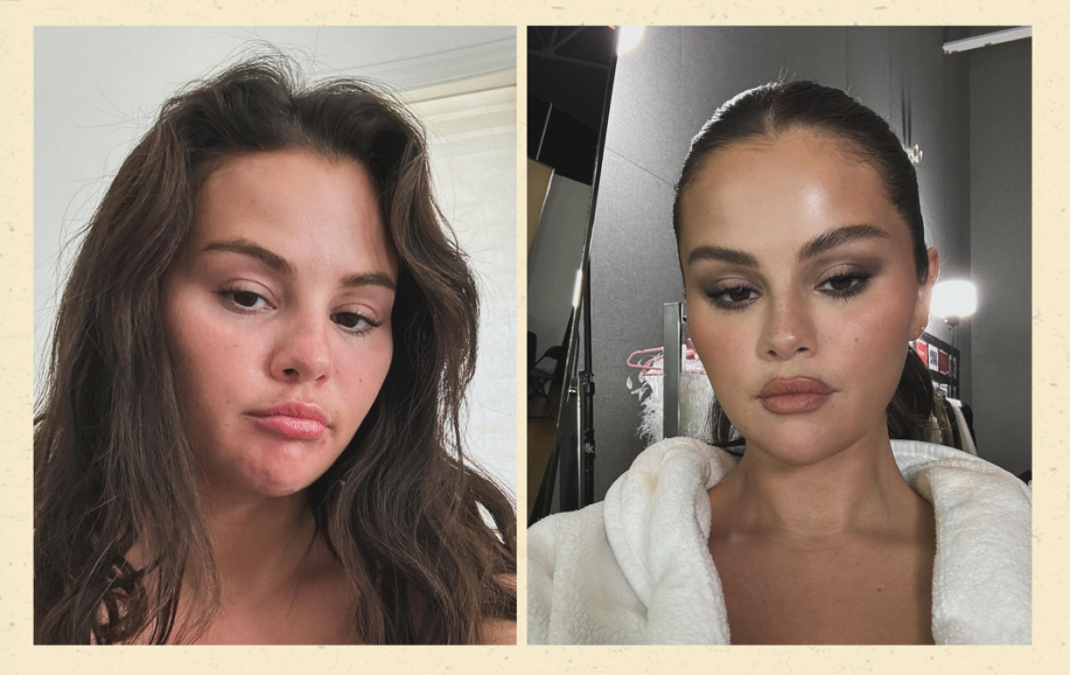 Selena Gomez: Με μια σειρά απο selfies έδωσε απάντηση στα επικριτικά σχόλια για τις πλαστικές επεμβάσεις